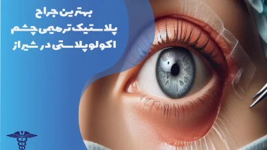 بهترین جراح پلاستیک ترمیمی چشم اکولوپلاستی در شیراز