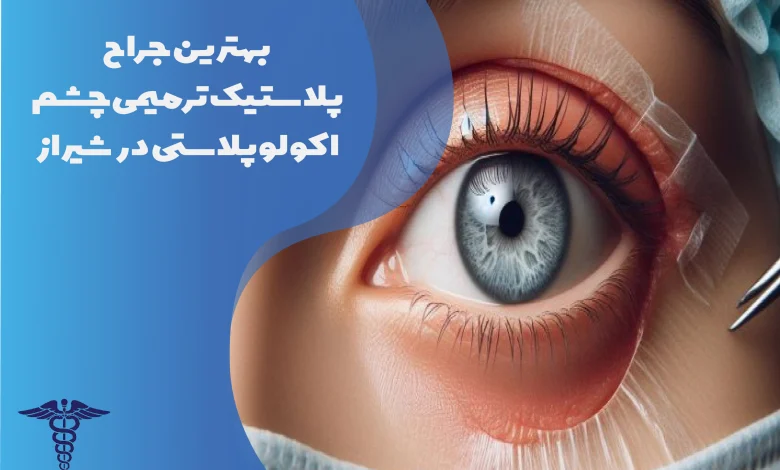 بهترین جراح پلاستیک ترمیمی چشم اکولوپلاستی در شیراز