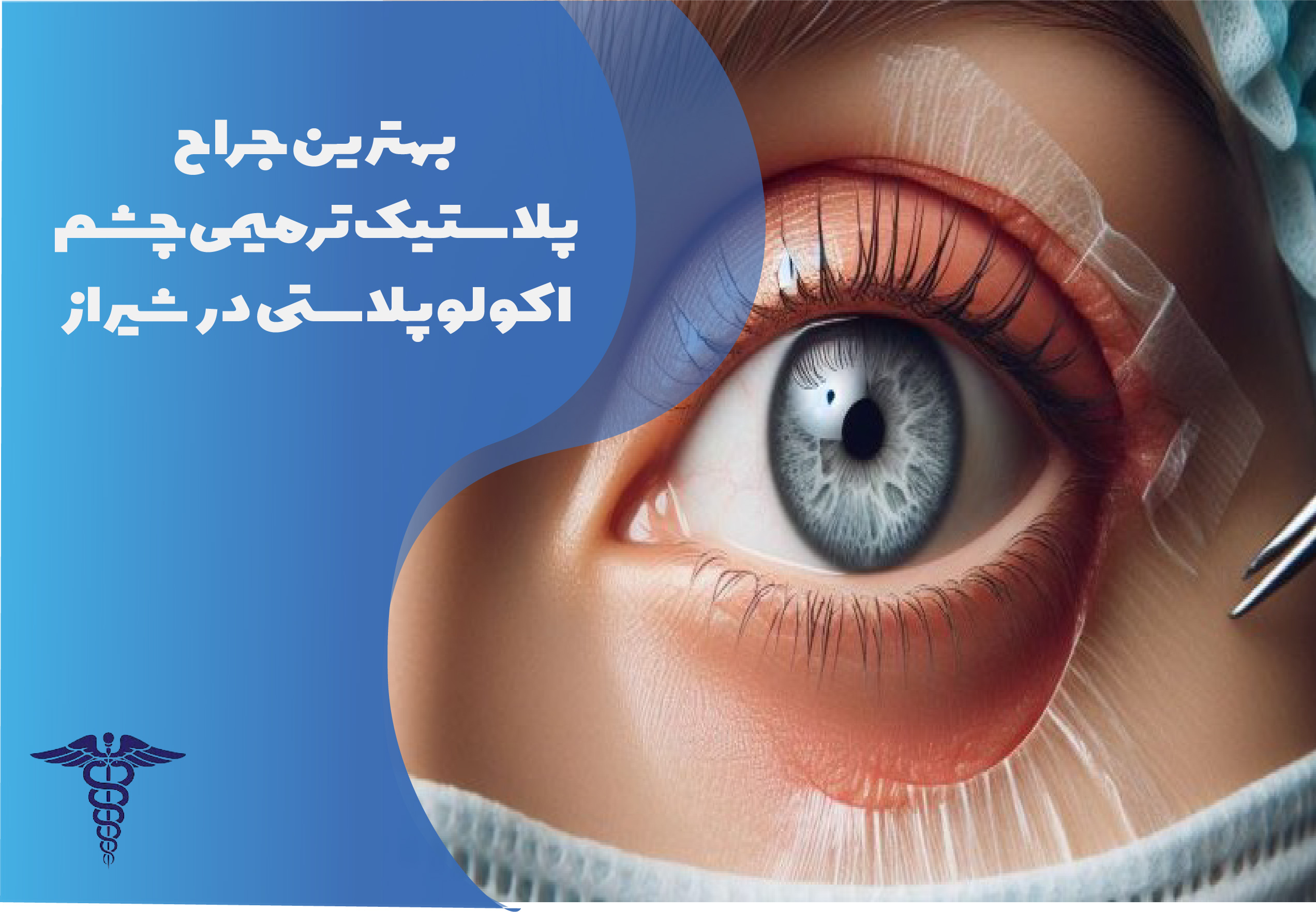 بهترین جراح پلاستیک ترمیمی چشم اکولوپلاستی در شیراز