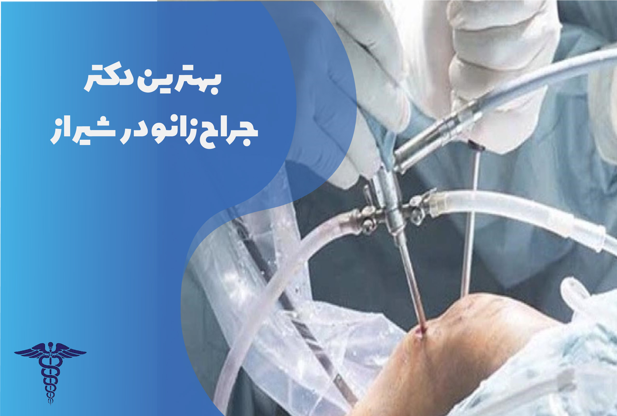 بهترین دکتر جراح زانو در شیراز