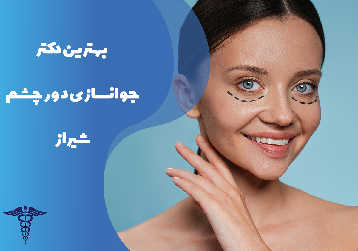 معرفی بهترین دکتر جوانسازی دور چشم شیراز