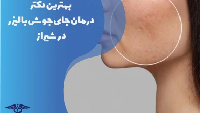 بهترین دکتر درمان جای جوش با لیزر در شیراز