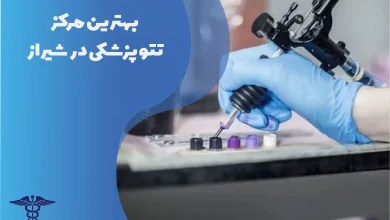 بهترین مرکز تتو پزشکی در شیراز