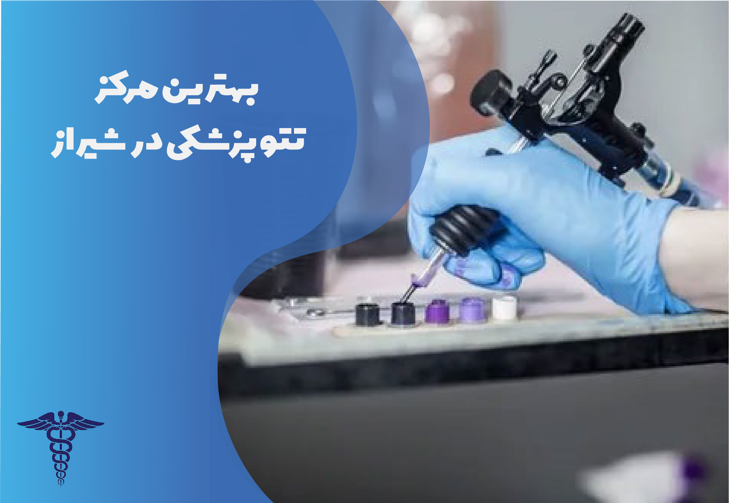 بهترین مرکز تتو پزشکی در شیراز
