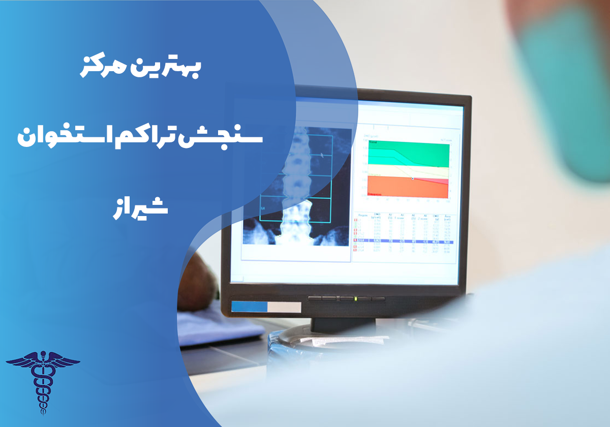 بهترین مرکز سنجش تراکم استخوان شیراز