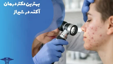 بهترین دکتر درمان آکنه در شیراز