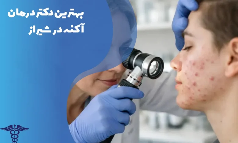 بهترین دکتر درمان آکنه در شیراز