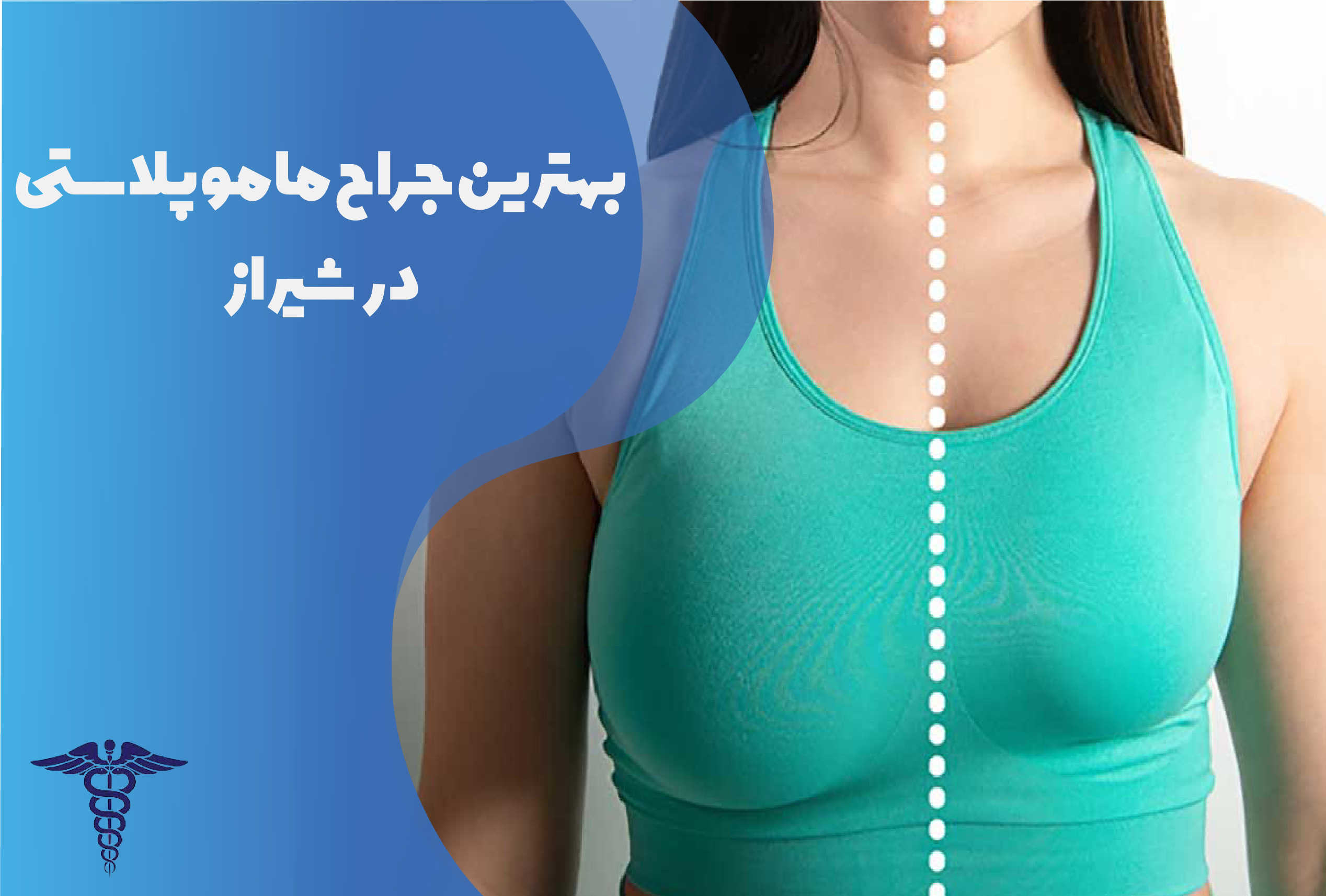 بهترین جراح ماموپلاستی در شیراز