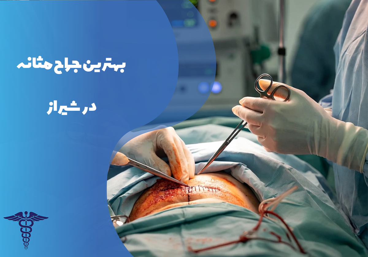معرفی 12 جراح برتر مثانه در شیراز – بهترین جراح مثانه شیراز کیست؟