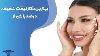 بهترین دکتر لیفت شقیقه در صدرا شیراز