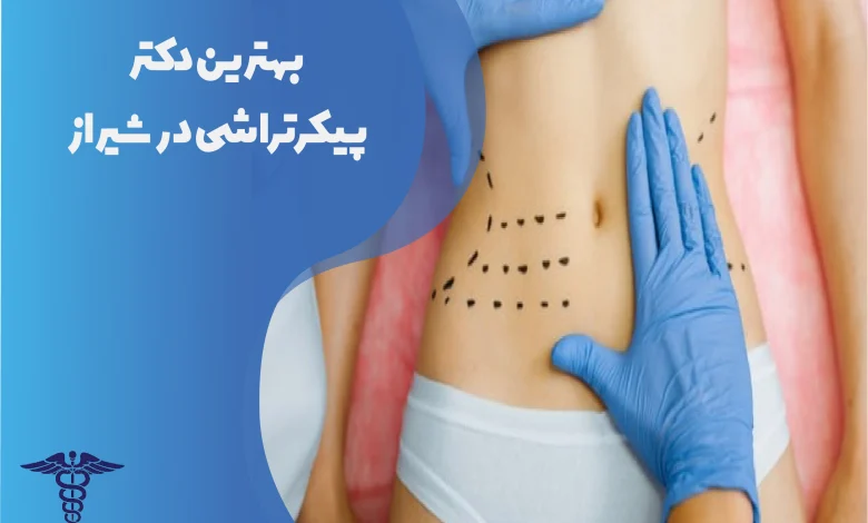 بهترین دکتر پیکرتراشی در شیراز