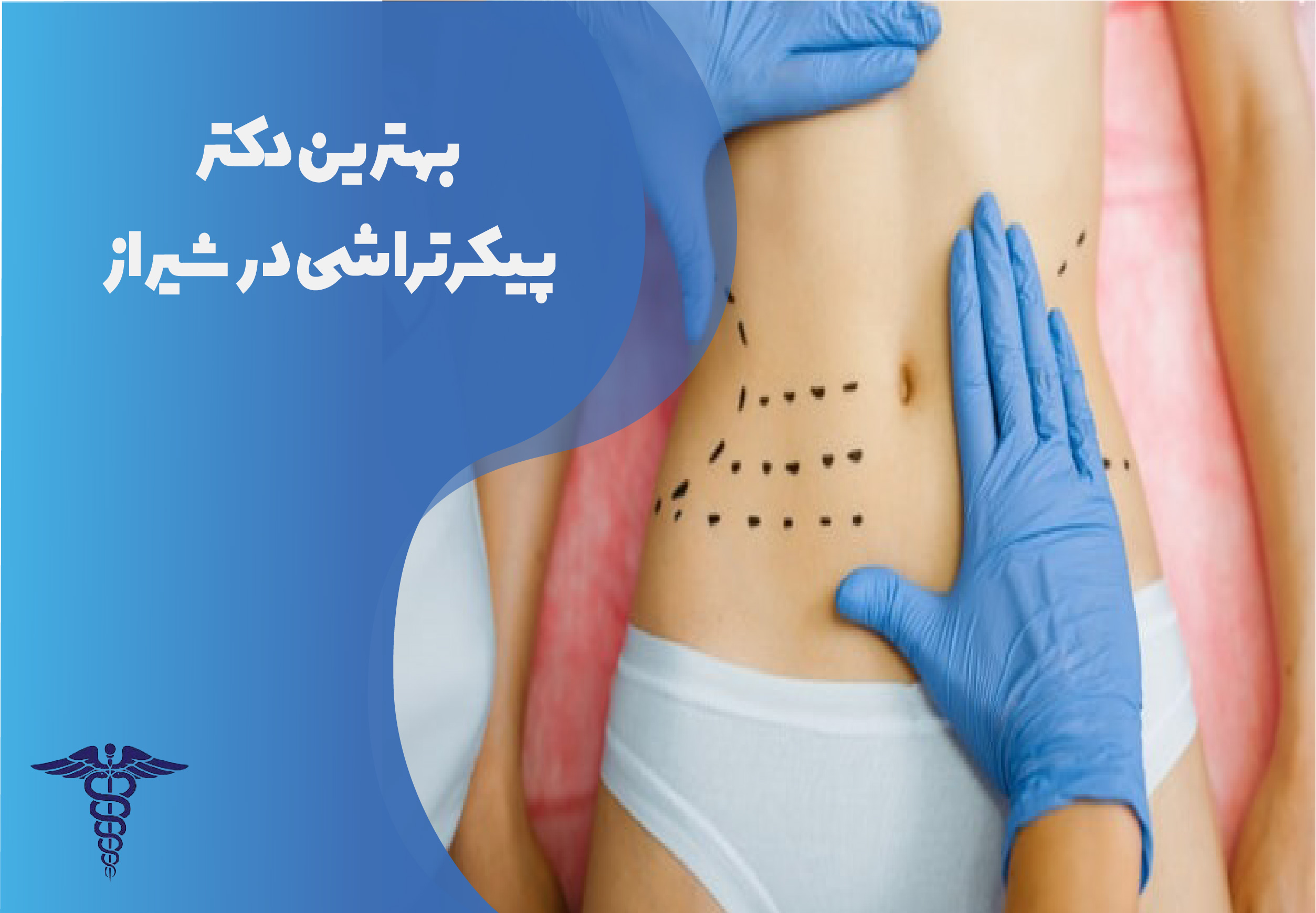 بهترین دکتر پیکرتراشی در شیراز