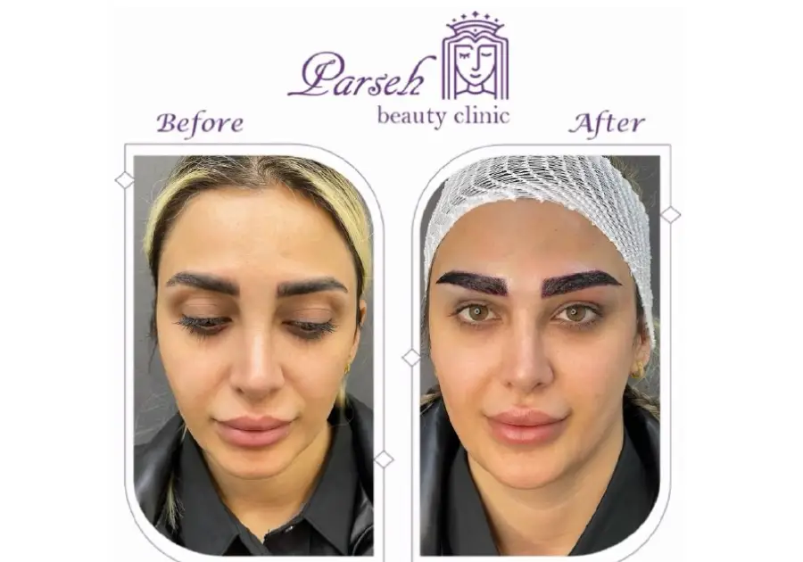 کلینیک پارسه، بهترین کلینیک کاشت ابرو در شیراز