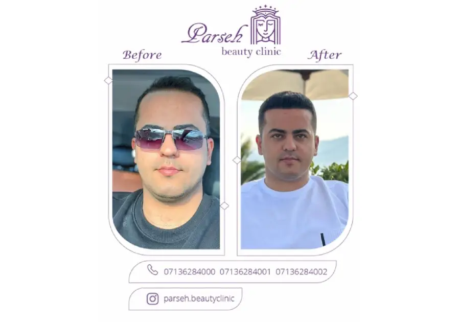 کلینیک پارسه، بهترین کلینیک کاشت مو در شیراز