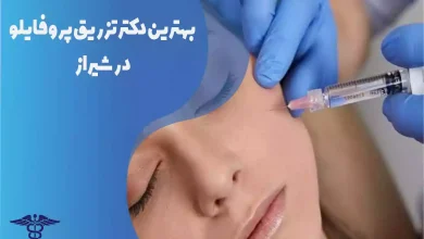 بهترین دکتر تزریق ژل پروفایلو در شیراز
