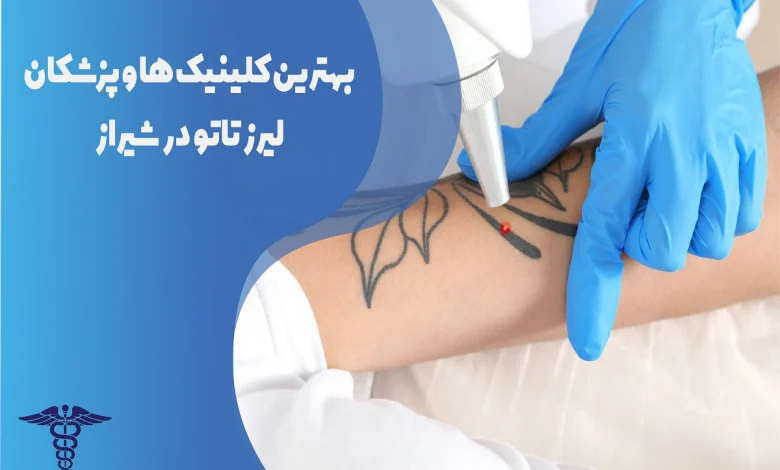 بهترین کلینیکها و دکترهای لیزر تاتو در شیراز