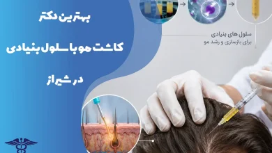 کاشت مو با سلول بنیادی در شیراز + واقعیت طبق منابع پزشکی