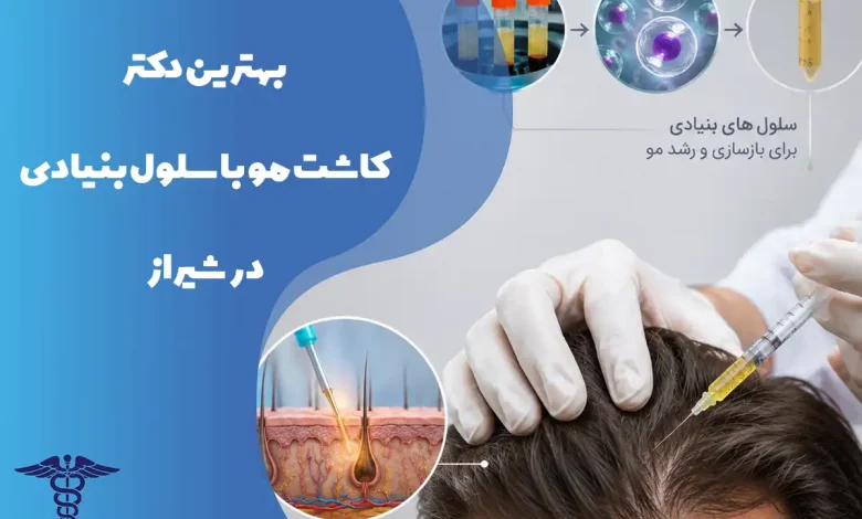 کاشت مو با سلول بنیادی در شیراز + واقعیت طبق منابع پزشکی