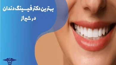 بهترین دکتر فیسینگ دندان در شیراز