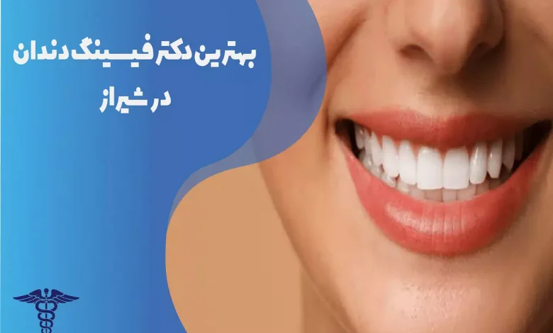 بهترین دکتر فیسینگ دندان در شیراز