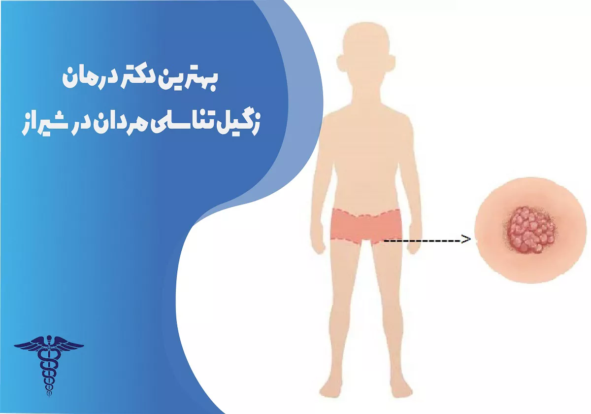 بهترین دکتر زگیل تناسلی مردان در شیراز