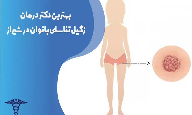 بهترین دکتر درمان زگیل تناسلی زنان در شیراز