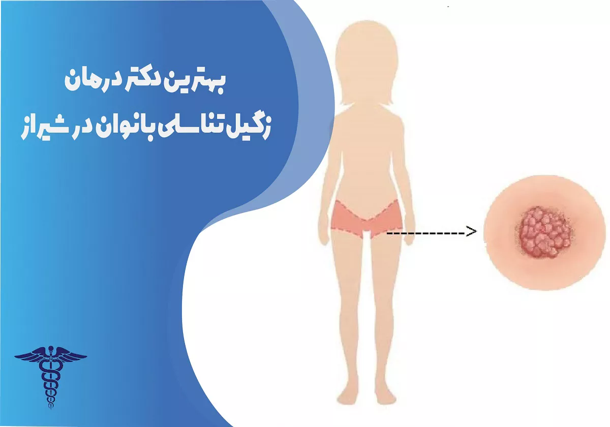 بهترین دکتر درمان زگیل تناسلی زنان در شیراز