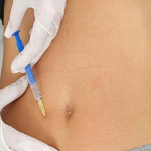 لاغزی موضعی